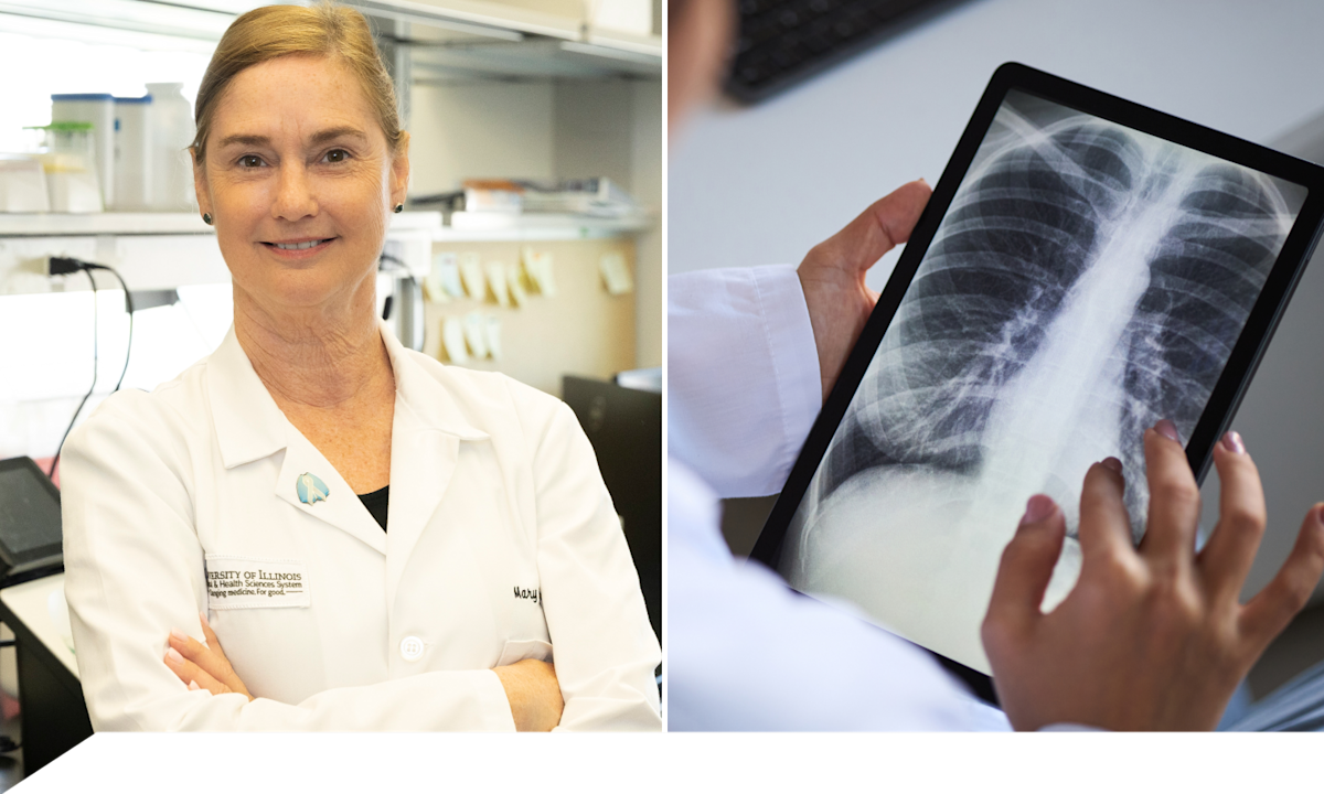 Ask An Expert: What You Need to Know About Lung Cancer Testing - theSkimm
